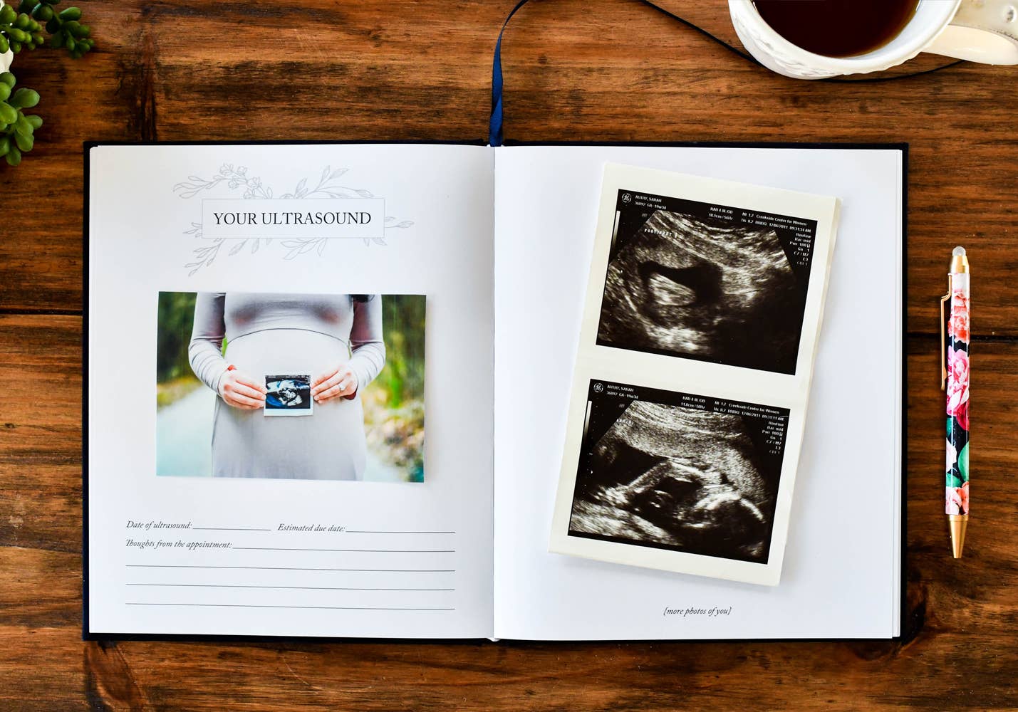 Dear Baby: A Pregnancy Prayer Journal & Memory Book for Moms: Gray