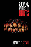 Show Me Where It Hurts cover image