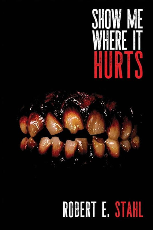 Show Me Where It Hurts cover image